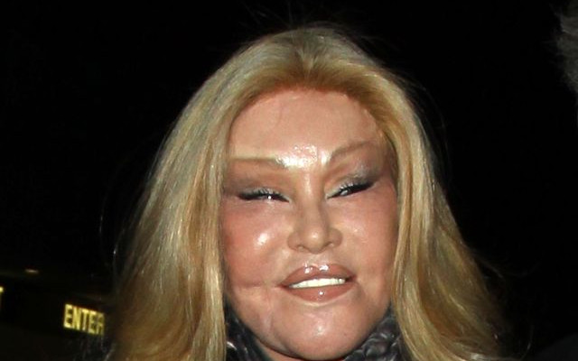 Jocelyn Wildenstein, czyli Kobieta Kot – wydała fortunę, żeby wyglądać jak potwór