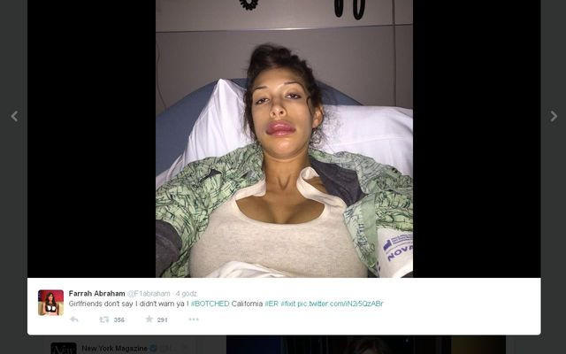 Farrah Abraham – ofiara nieudanego zabiegu powiększania ust