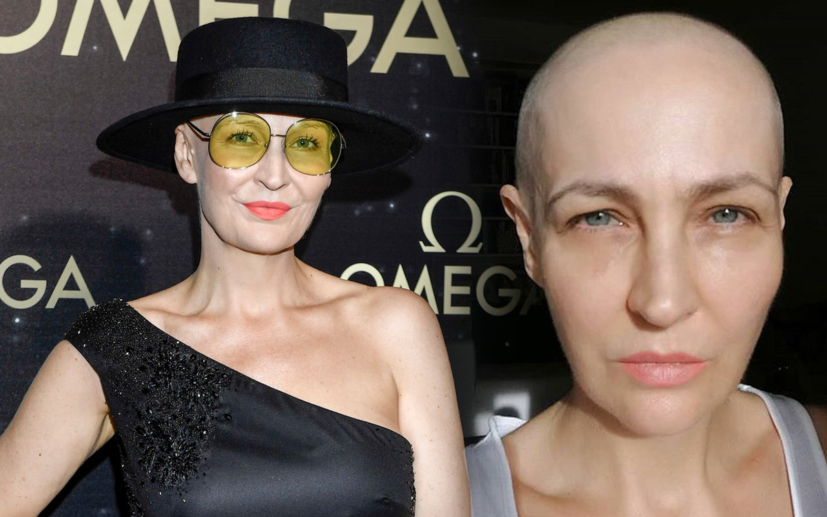 Chora na raka Anna Puślecka napisała list otwarty do Ministra Zdrowia: czy ma Pan prawo skazywać nas na przedwczesną śmierć?