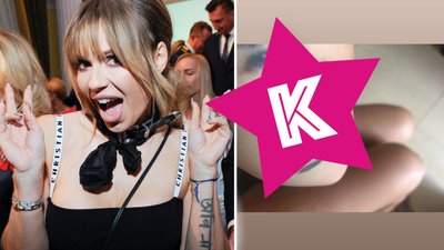 Doda pokazała tatuaż po usuwaniu laserowym. SZOK! Męczy się z nim już dwa lata