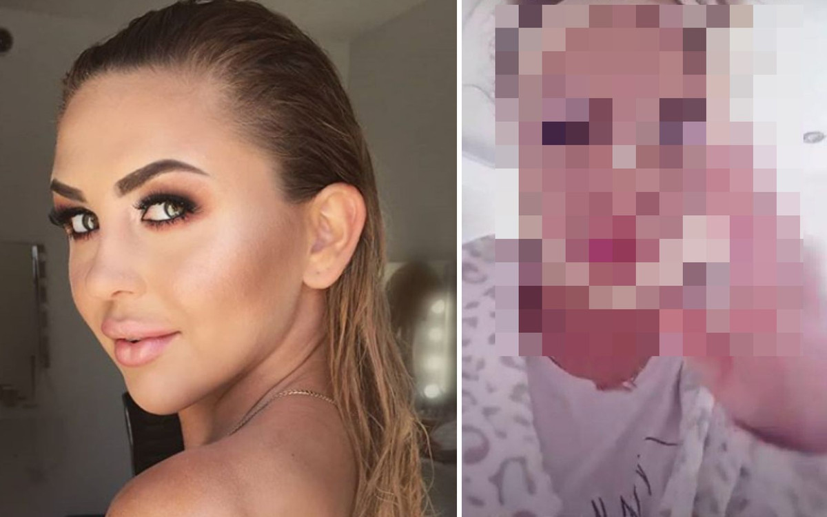 Finalistka “Projekt Lady” zrobiła operację plastyczną. “Nie mam obsesji!”