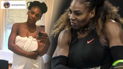 Serena Williams przyznała się do wielkich kompleksów