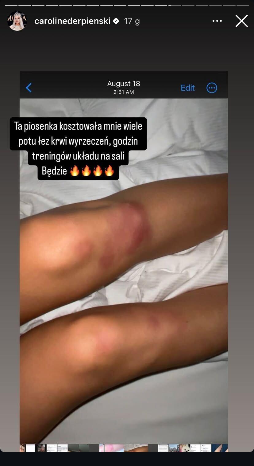 Caroline Derpieński, fot. Instagram.