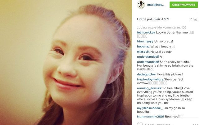 Modelka z zespołem Downa reklamuje sportowe stroje