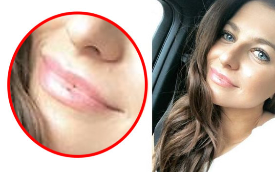 Kropka na ustach Anny Lewandowskiej – czy trenerka powiększa usta?