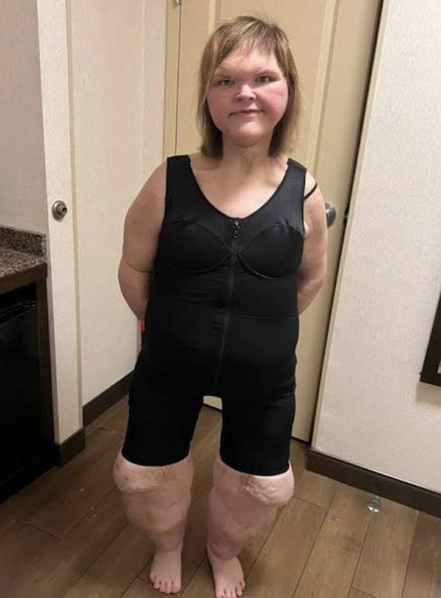 Gwiazda TLC wywalczyła nowe życie! Schudła ponad 226 kg i zainwestowała w nowy uśmiech (FOTO)