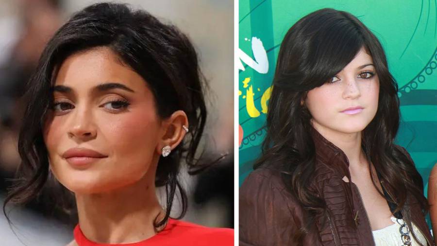 Co poprawiała sobie Kylie Jenner? Specjalista medycyny estetycznej wylicza….