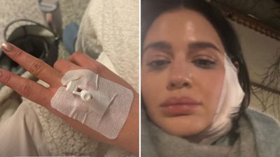 Polska wokalistka spędziła 8h na SOR. W poniedziałek nocą rozegrał się dramat