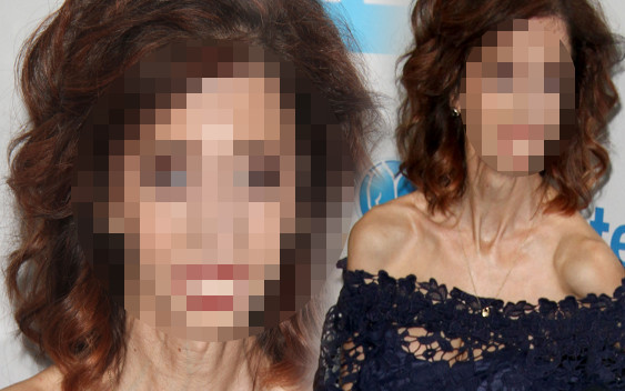 Nazwano ją najbrzydszą kobietą świata, dziś pozuje na ściankach (ZDJĘCIA)