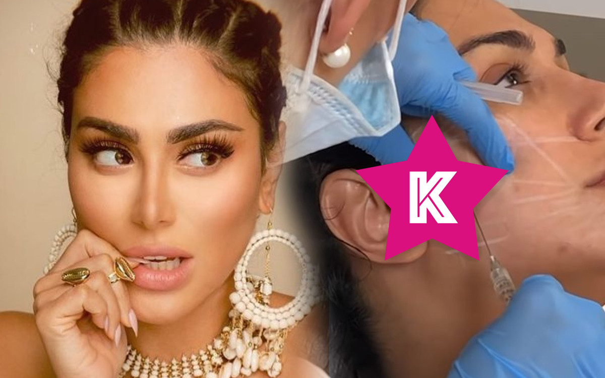 Huda Kattan pokazuje, jak cierpi podczas wypełniania twarzy KWASEM i botoksem