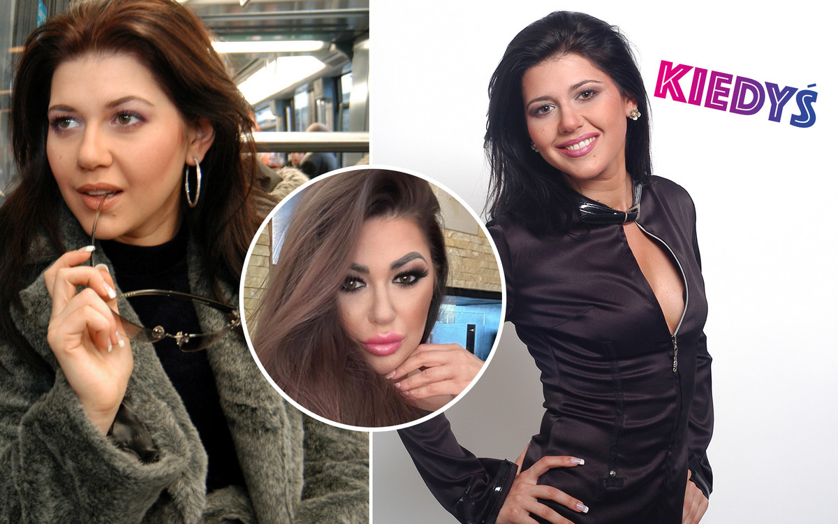 Iwona Węgrowska szczerze o nieudanych operacjach plastyczych! “Żyłam w zagrożeniu życia”