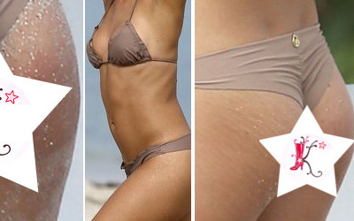 Ta polska piękność też walczy z rozstępami (FOTO)