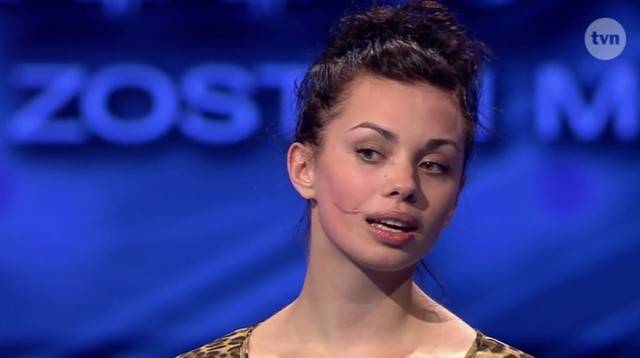 Uczestniczka "Top Model" z blizną. Jak dziś wygląda Anna Koryto?