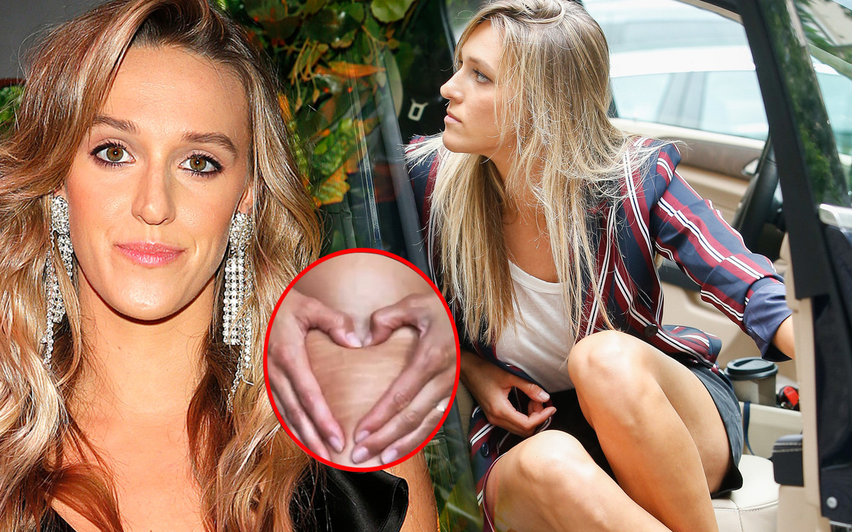 Ola Żebrowska pokazała rozstępy na udzie: To nie są blizny po porodzie