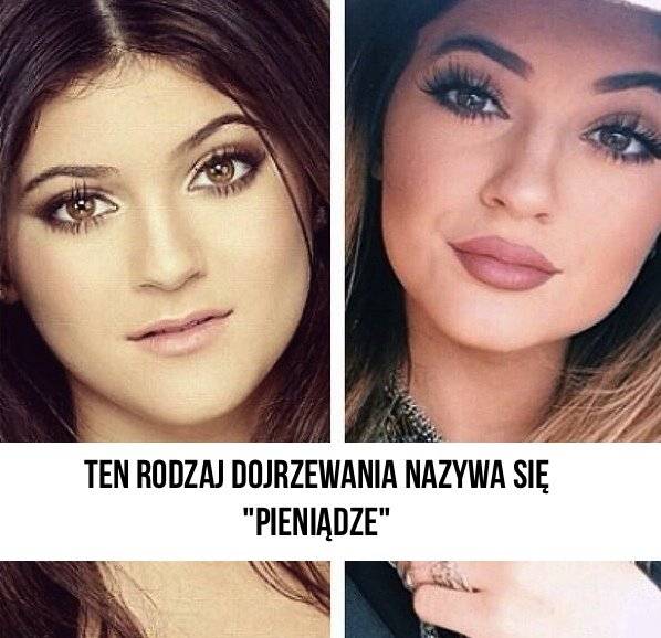 Kylie Jenner i jej usta na memach
