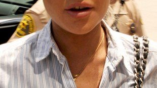 Zęby Lindsay Lohan są pożółkłe i zepsute (FOTO)