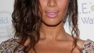 Czy to efekt operacji czy znowu przytyła? (FOTO)