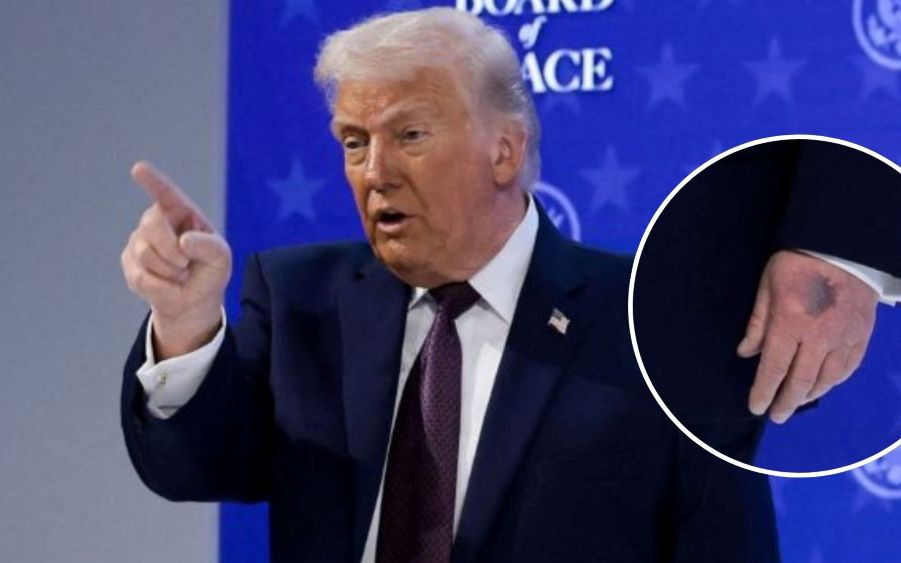 Huknęły wieści o zdrowiu Trumpa. Biały Dom wydał oświadczenie