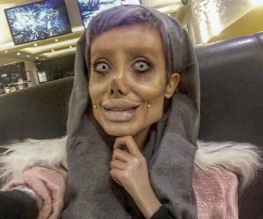 Jej marzeniem było być jak Angelina Jolie, a teraz STRASZY swoim wyglądem