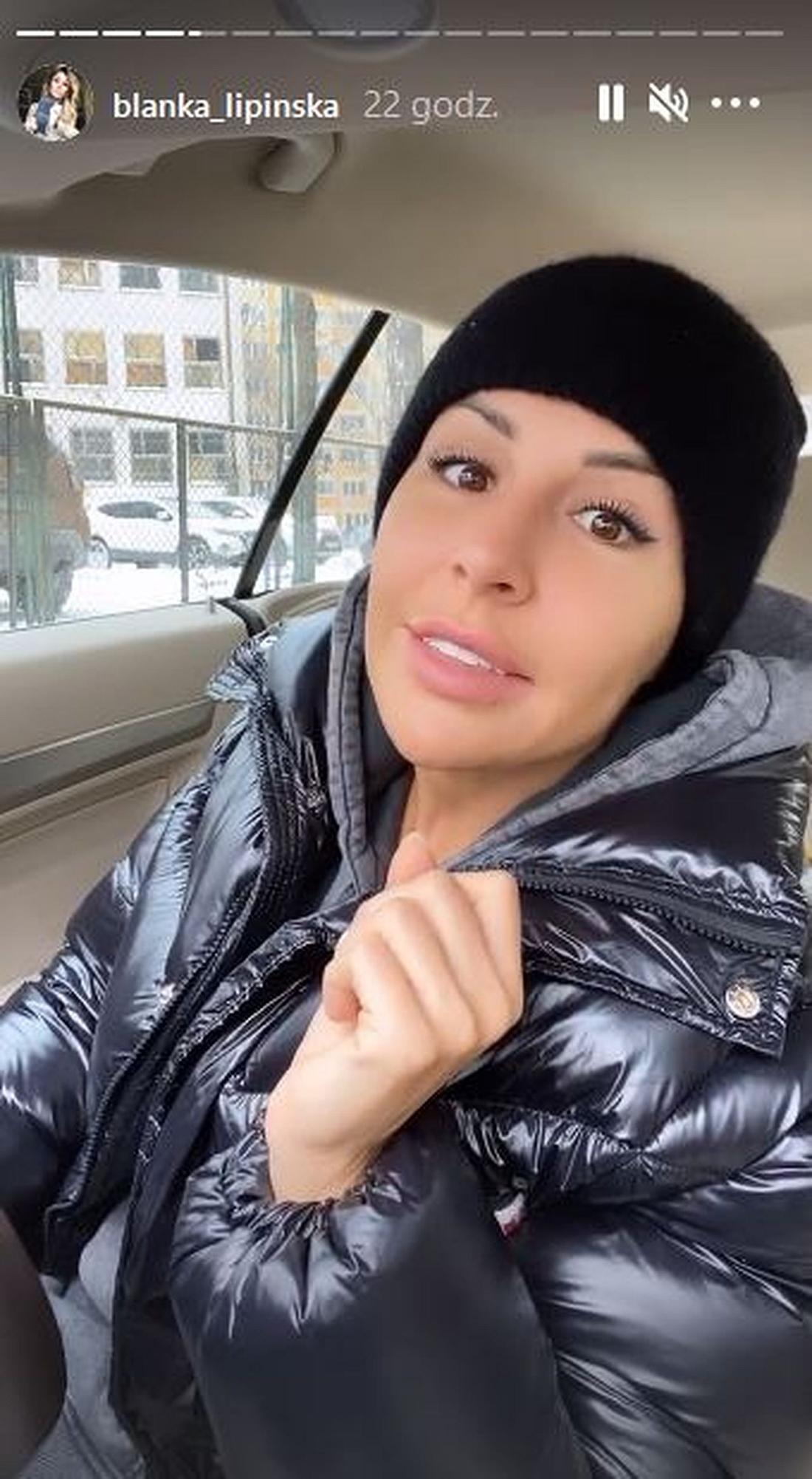 Blanka Lipińska zrobiła bonding zębów. 