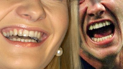 TE gwiazdy miały TRAGICZNE zęby!
