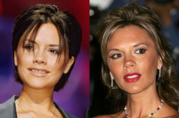 Jak zęby zmieniły twarze gwiazd