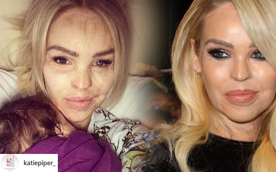 Oblana kwasem Katie Piper jest PRZERAŻONA. Jej oprawca może wyjść na wolność