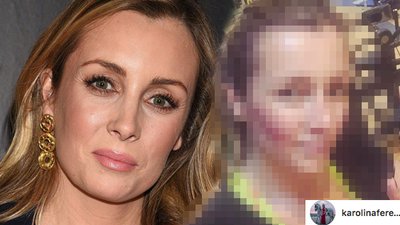 Karolina Ferenstein-Kraśko BARDZO schudła! (ZDJĘCIE)