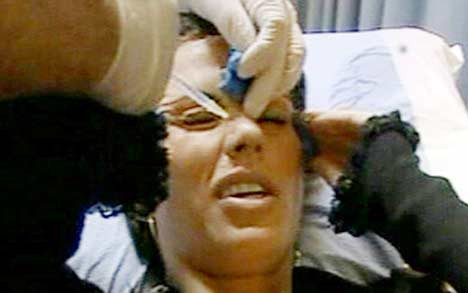 Kto się pompuje botoksem na wizji?