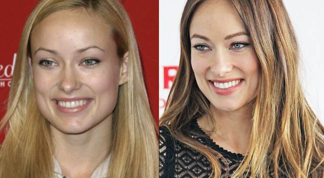 Jakich zabiegów urodowych żałują gwiazdy?