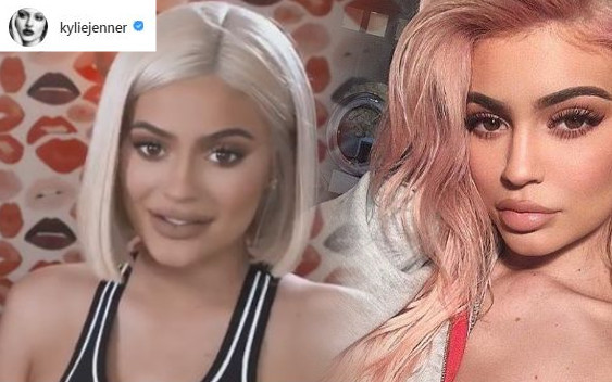 Bieda! W ciąży usta Kylie mogą się DRASTYCZNIE zmienić!