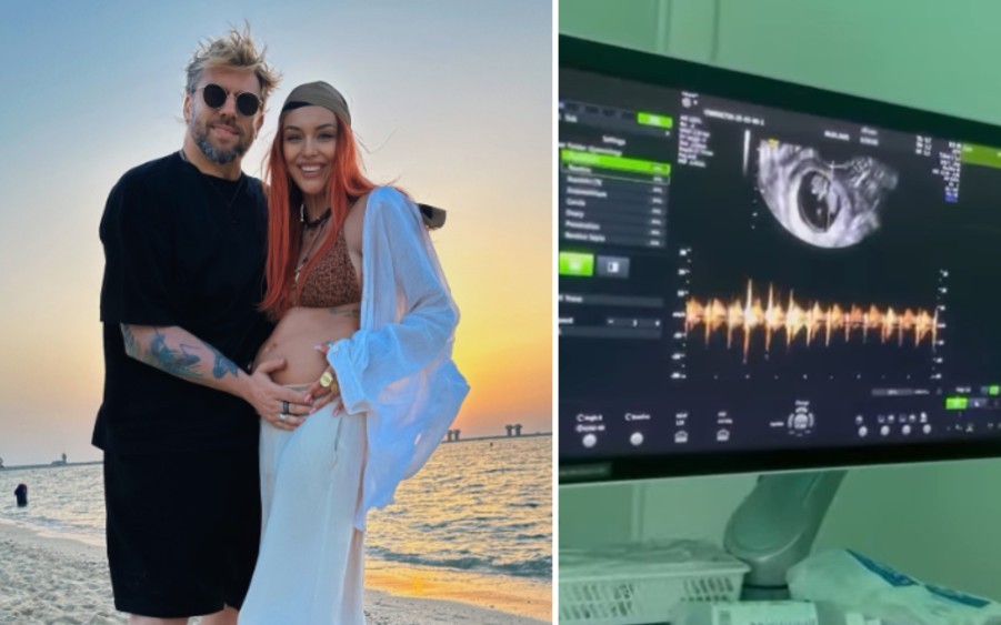 Gwiazda z “Red Lips” jest W CIĄŻY!