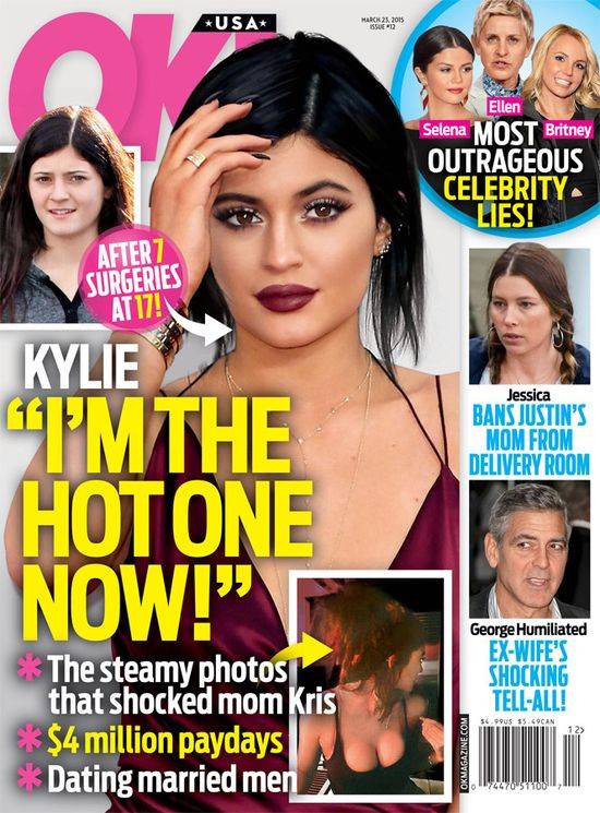 Kylie Jenner przed i po operacjach plastycznych