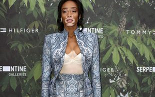 Winnie Harlow, modelka z bielactwem, spełnia swe marzenia
