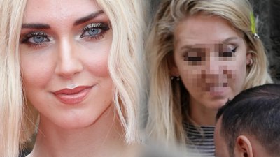 Chiara Ferragni BEZ PHOTOSHOPA i filtrów (ZDJĘCIA)