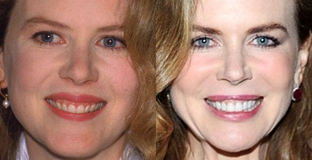 Jak zęby zmieniły twarze gwiazd