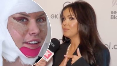 Nie mogła uwierzyć! Sylwia Bomba mocno o liftingu Julii von Stein