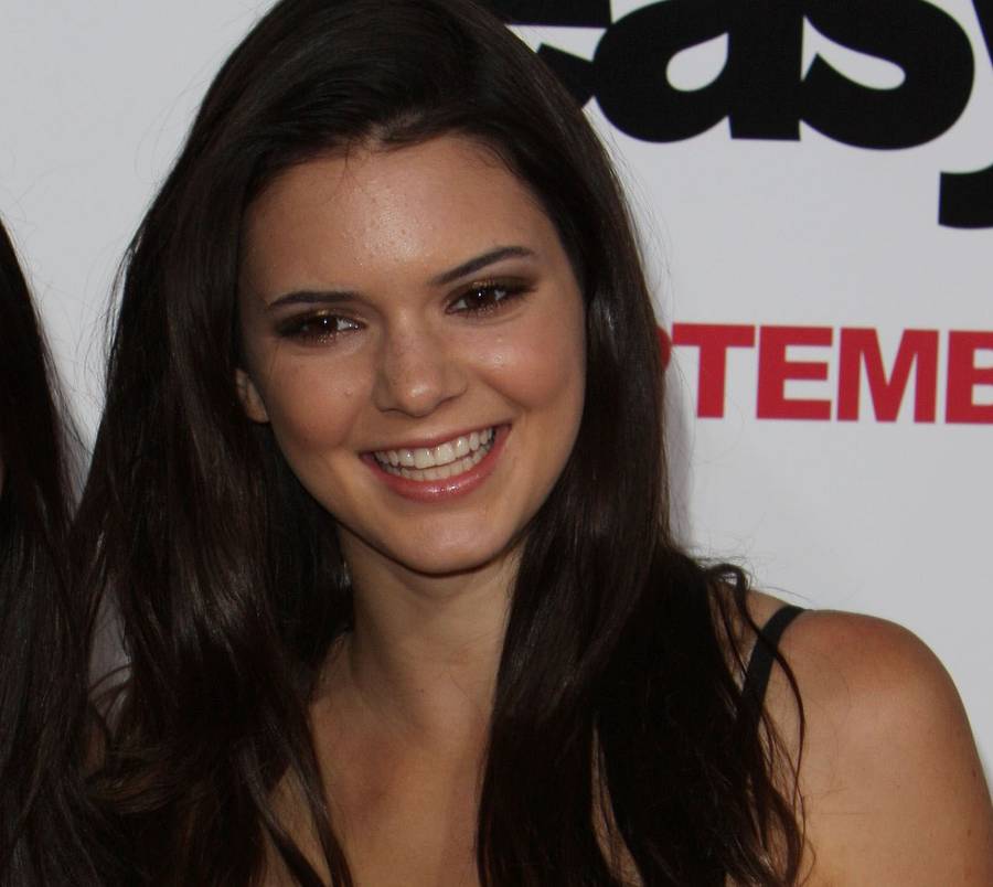 Jak zmieniła się Kendall Jenner? Sprawdziliśmy, czy coś majstrowała przy twarzy