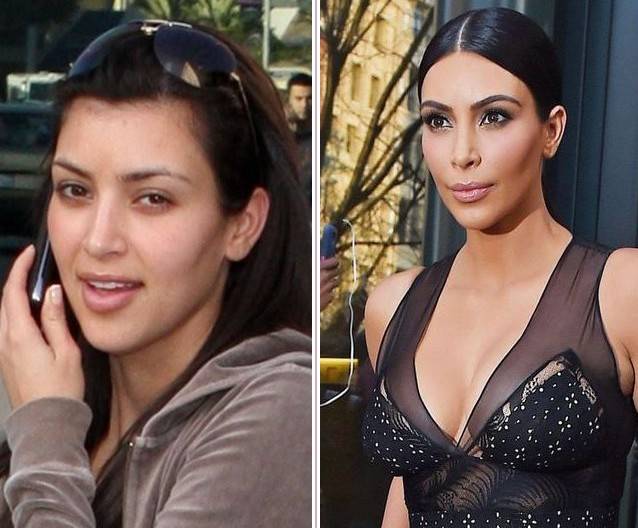 Nie ma ludzi brzydkich, są tylko biedni