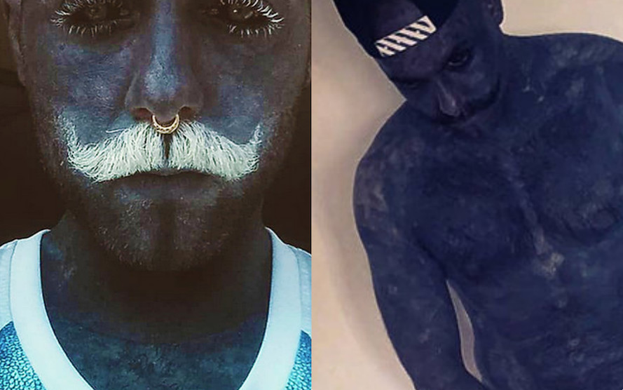 Adam Curlykale po usunięciu genitaliów w końcu pokazał krocze. NIE KŁAMAŁ