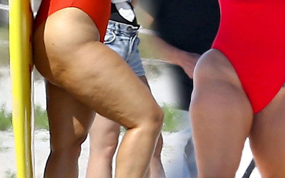 Ma cellulit i nic sobie z tego nie robi (ZDJĘCIA)