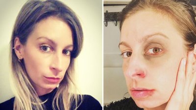 Magdalena Schejbal z PODBITYM okiem apeluje: “Pod makijażem, kobiety ukrywają swój ból”