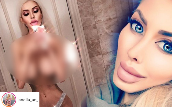 Stało się. Anella pokazała BIUST! Ma z nim problem…