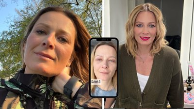 Odeta Moro zdecydowała się na operację plastyczną. Pokazała, jak teraz wygląda jej twarz