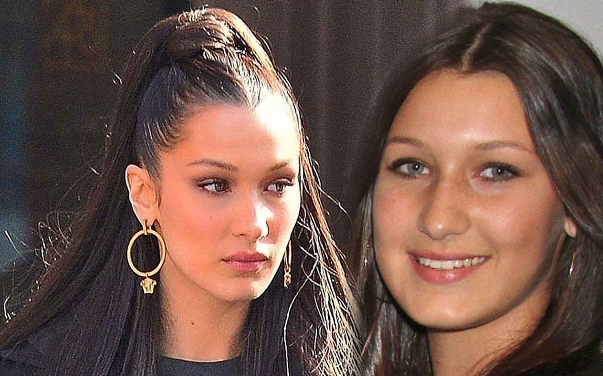 Bella Hadid jest naturalnie piękna? Nikt nie wie, ile operacji plastycznych przeszła!
