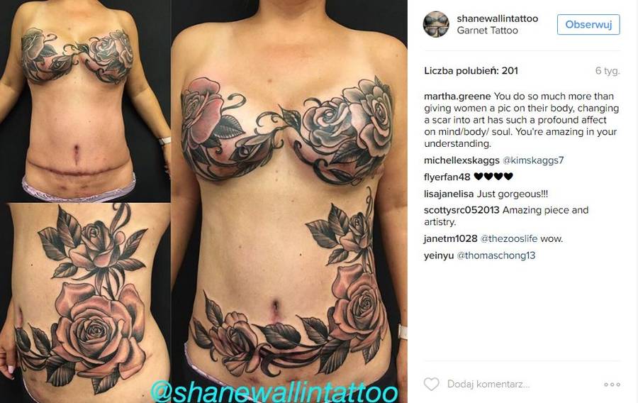 Tatuaże, które kamuflują blizny