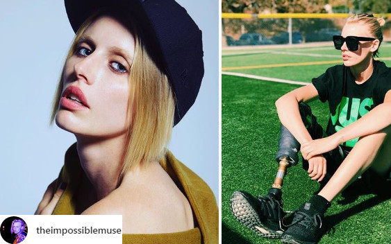 Modelka straciła nogę przez TAMPONY. Podzieliła się SZOKUJĄCYMI szczegółami