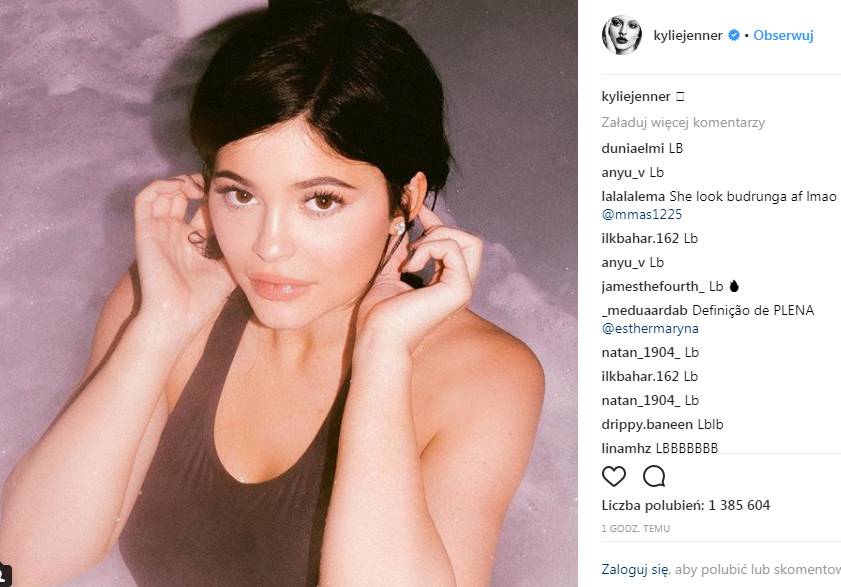 Co się dzieje z ustami Kylie?! Na temat jej wielkich warg wypowiedział się EKSPERT