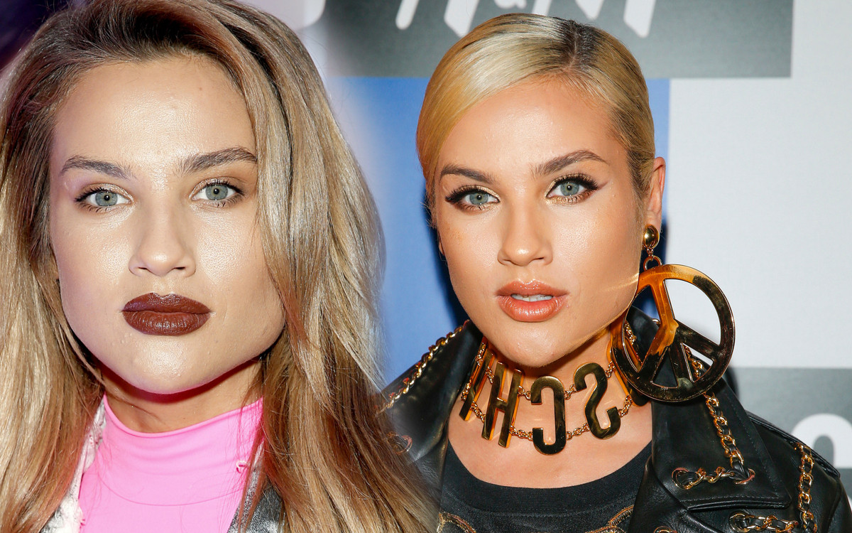 Karolina Gilon otwarcie o swoim defekcie: Moja twarz nie jest idealnie symetryczna