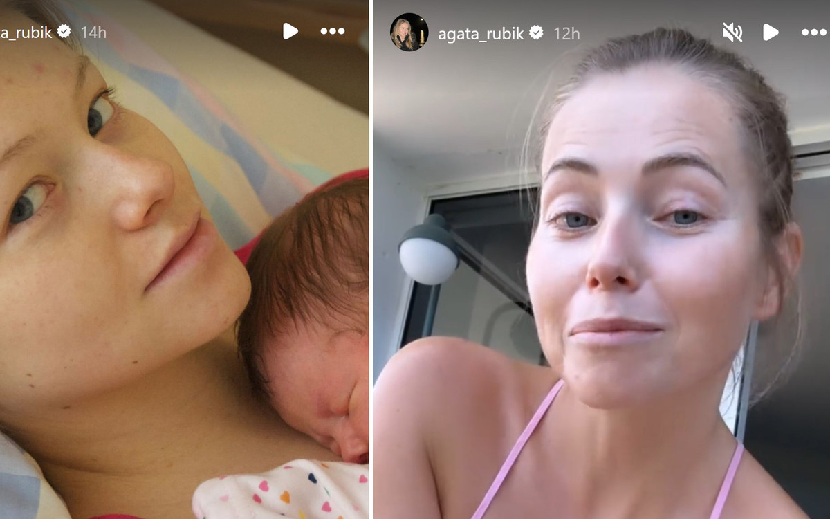 Agata Rubik zdradza, co sobie POPRAWIŁA! “Wycięłam sobie już dawno temu”